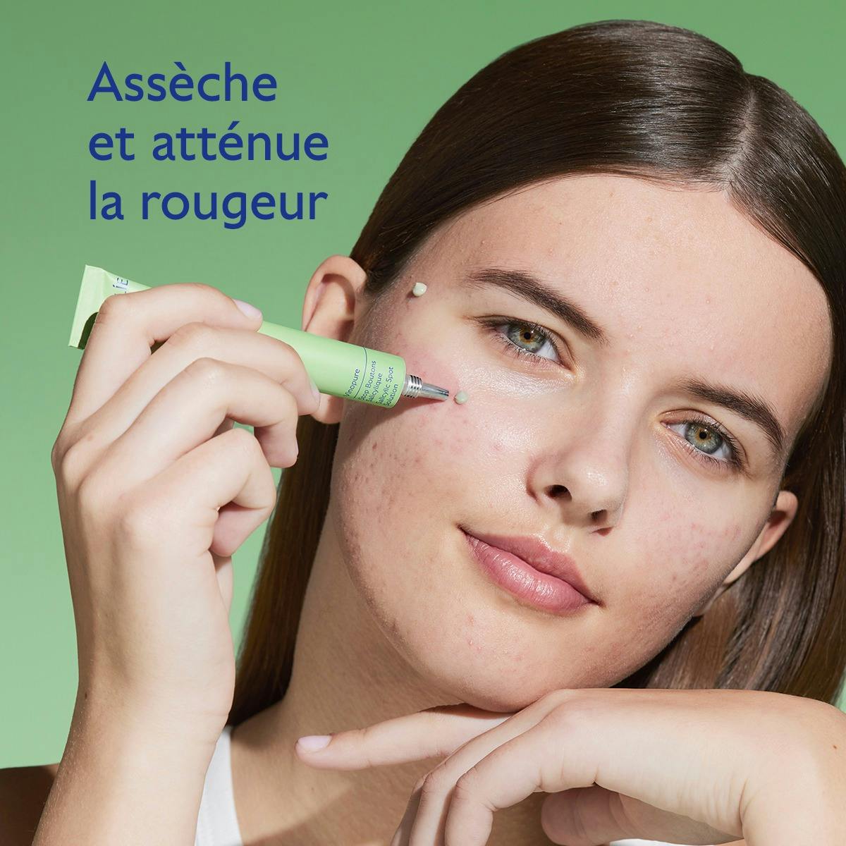 Stop Boutons Salicylique l'Acide Salicylique