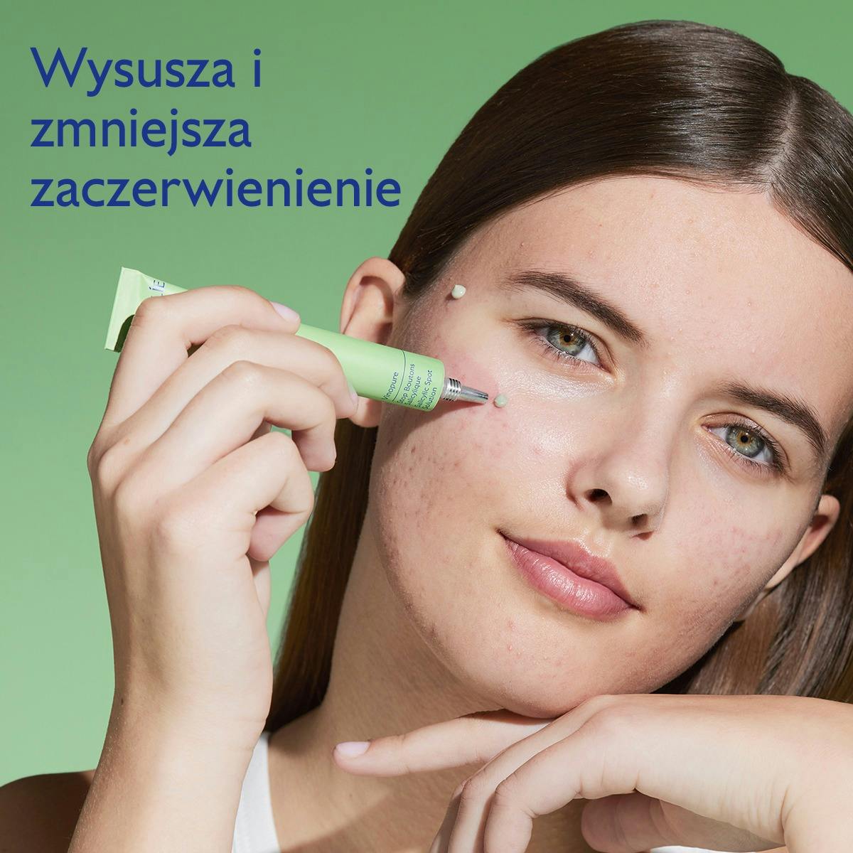 Punktowa kuracja z kwasem salicylowym