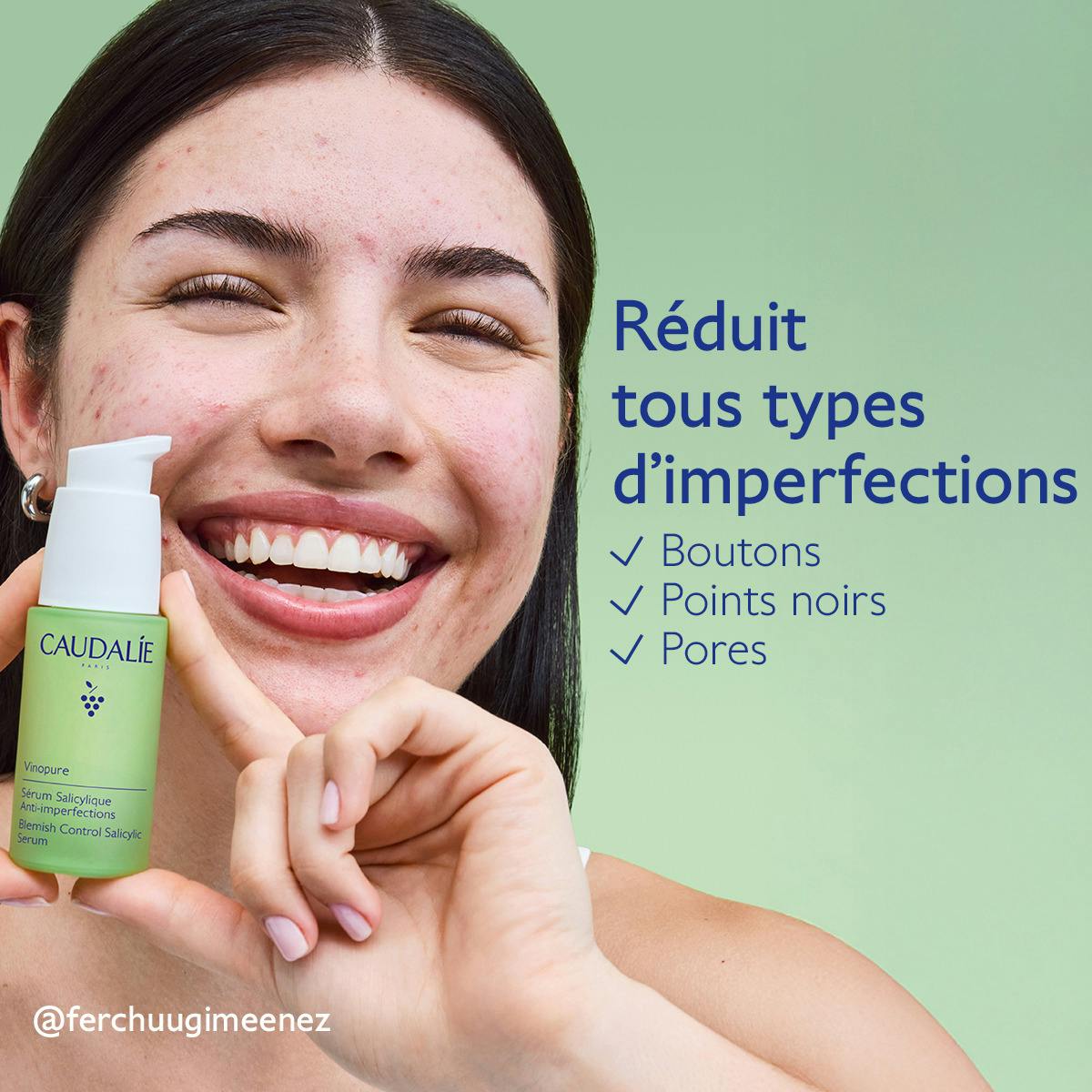 Sérum à l'Acide Salicylique Anti-imperfections