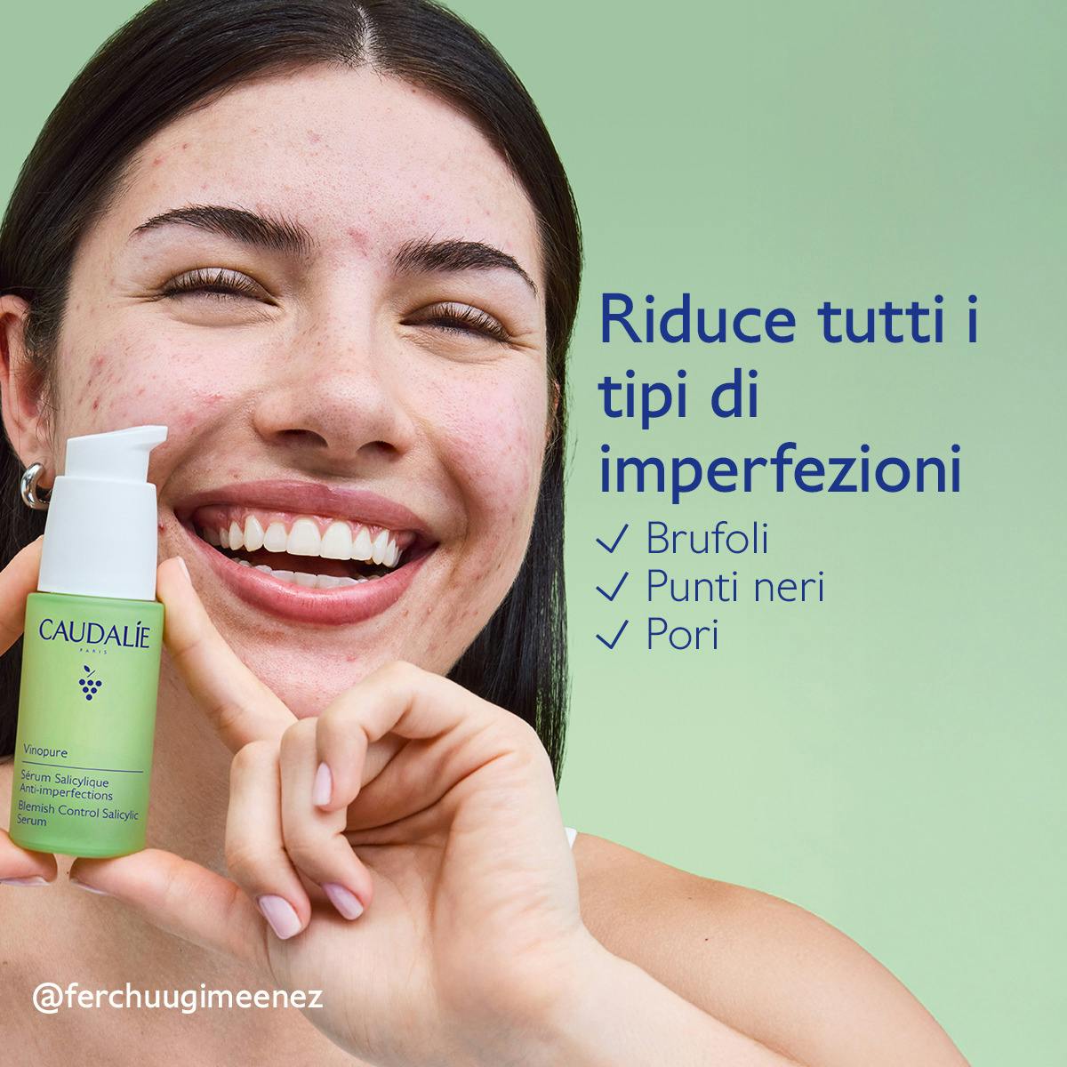 Siero all'Acido Salicilico Anti-imperfezioni