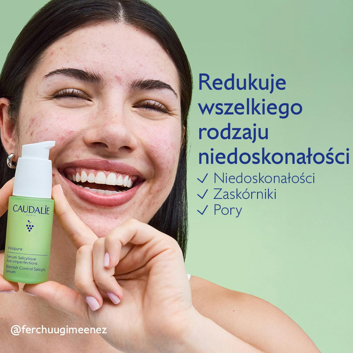 Serum z kwasem salicylowym na niedoskonałości