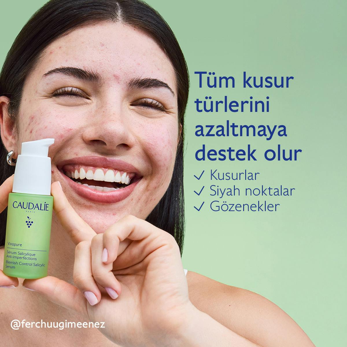 Akne Karşıtı Salisilik Serum