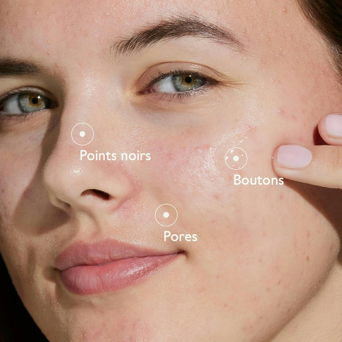 Routine Anti-imperfection globale