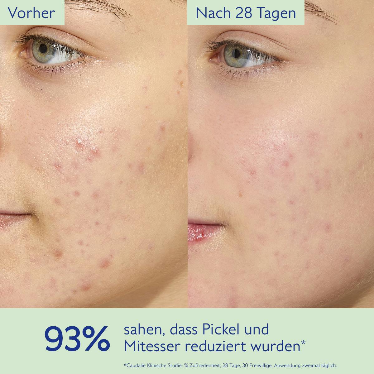 Mattierendes Feuchtigkeit spendendes Fluid mit Siliziumpulver