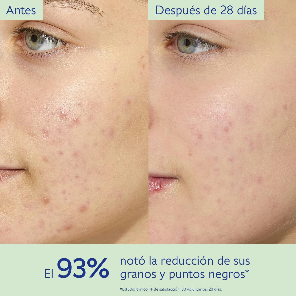 Fluido Matificante Hidratante