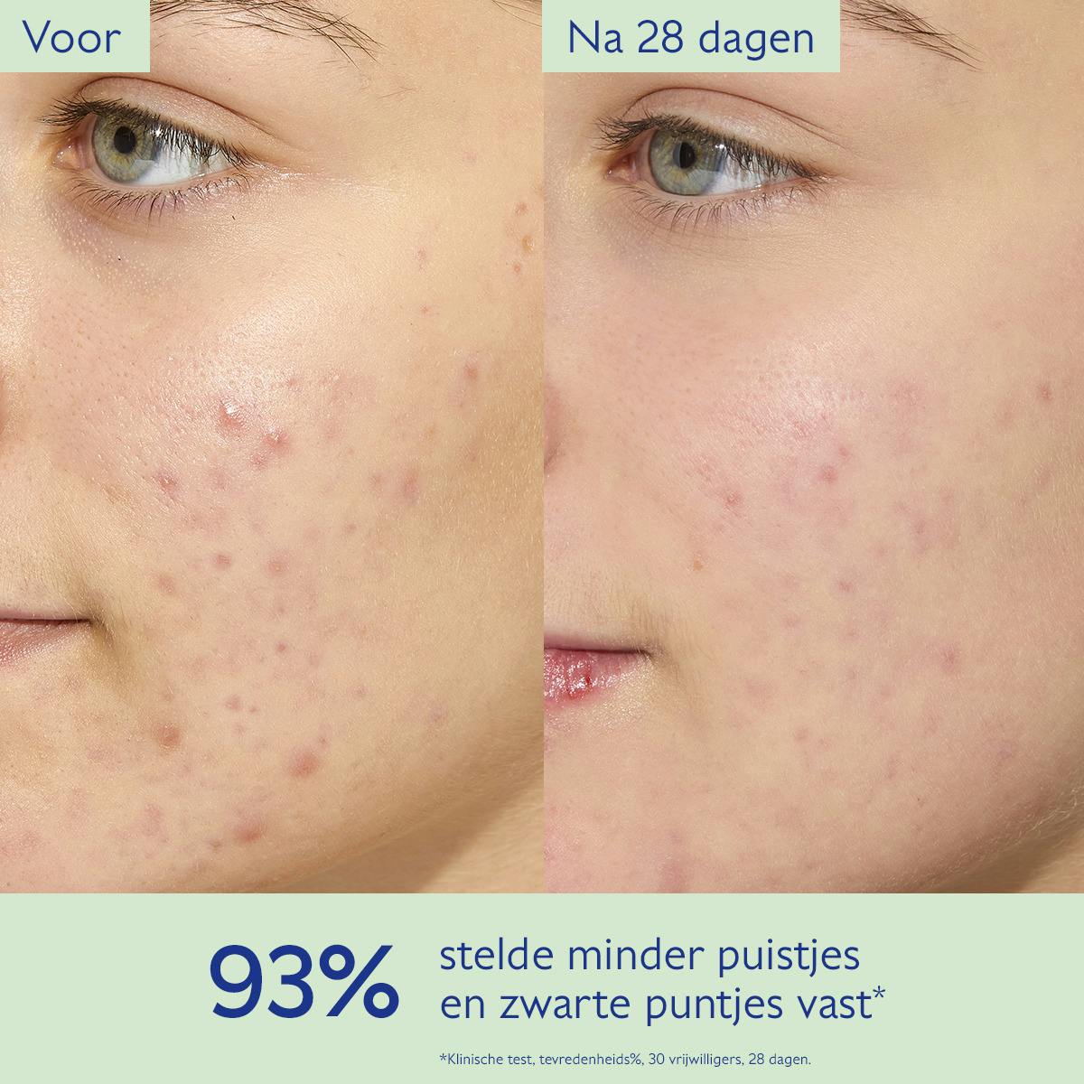 Hydraterende en Matmakende Fluide met Siliciumpoeder