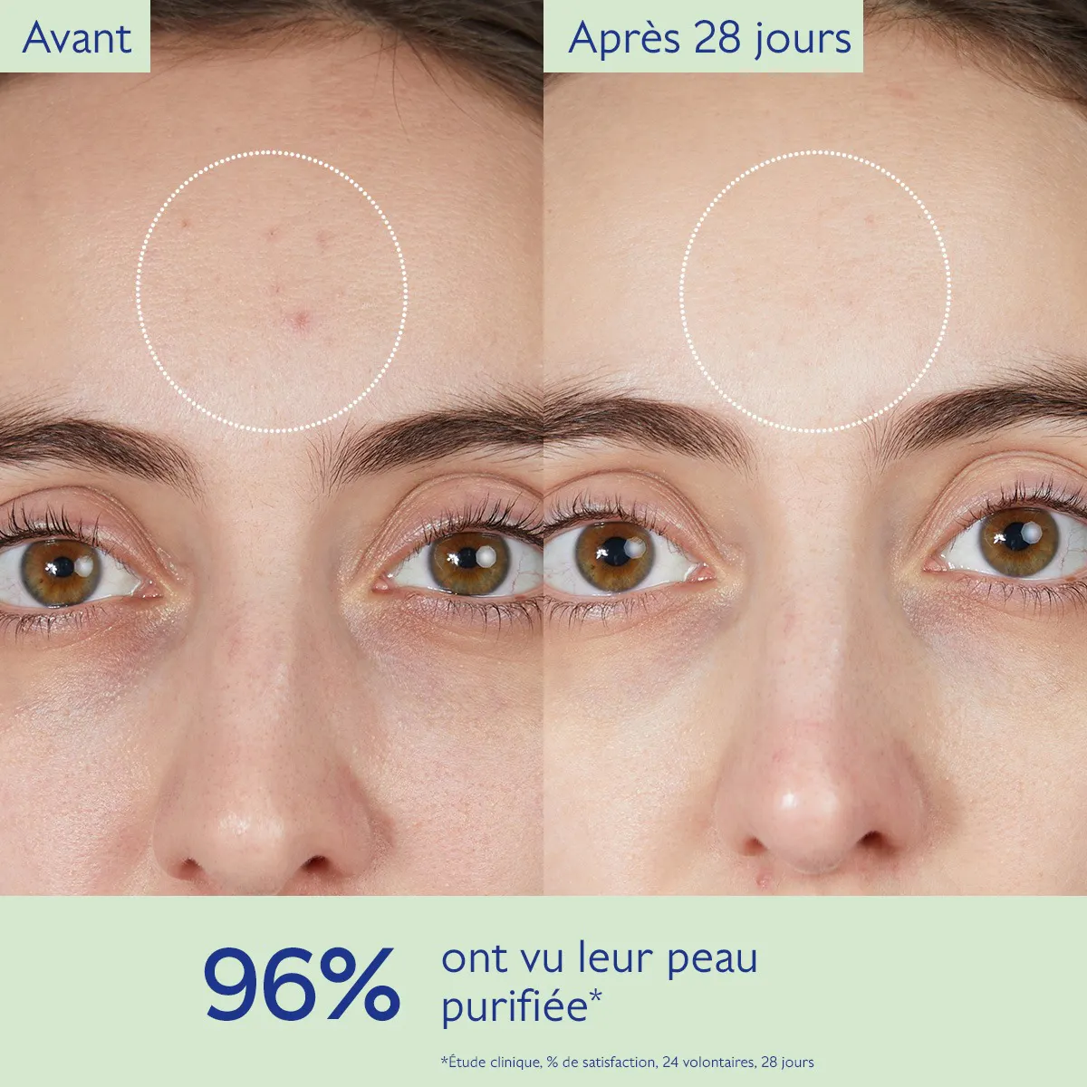 Gelée Nettoyante à l'Acide Salicylique Purifiante