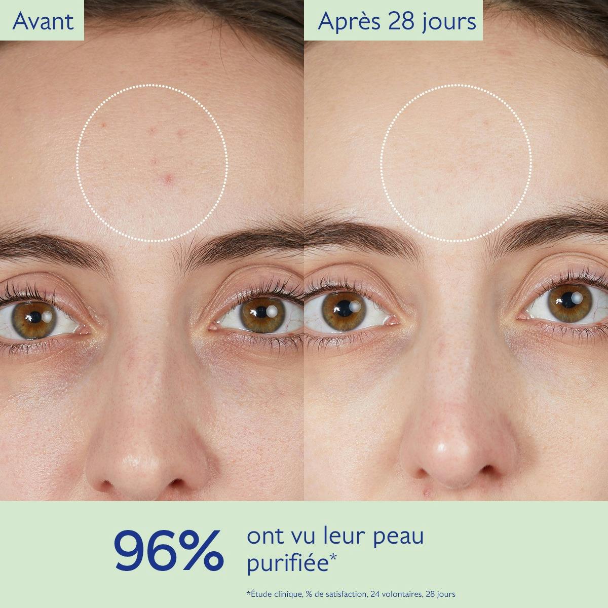 Gelée Nettoyante à l'Acide Salicylique Purifiante