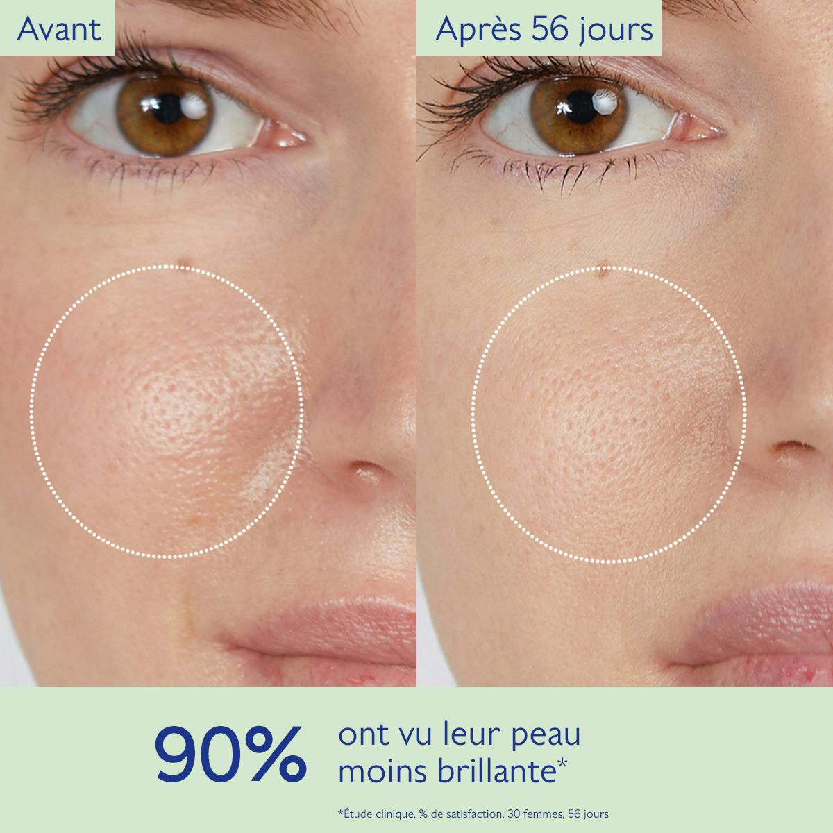 Lotion Purifiante à l'Acide Salicylique