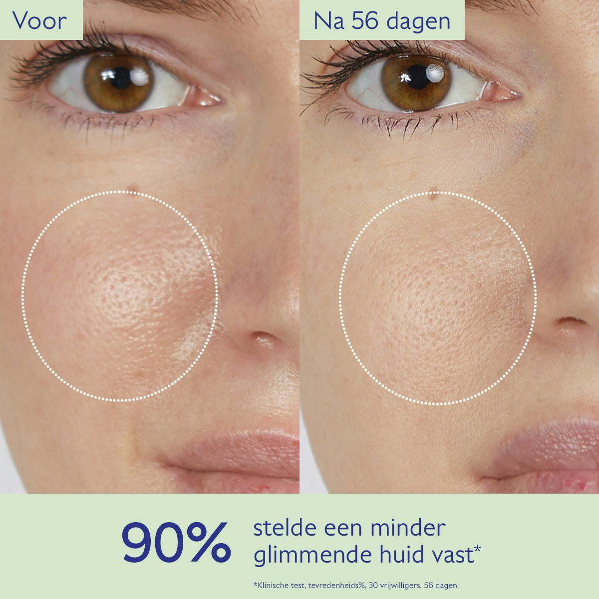 Zuiverende Lotion met Salicylzuur - 200mL
