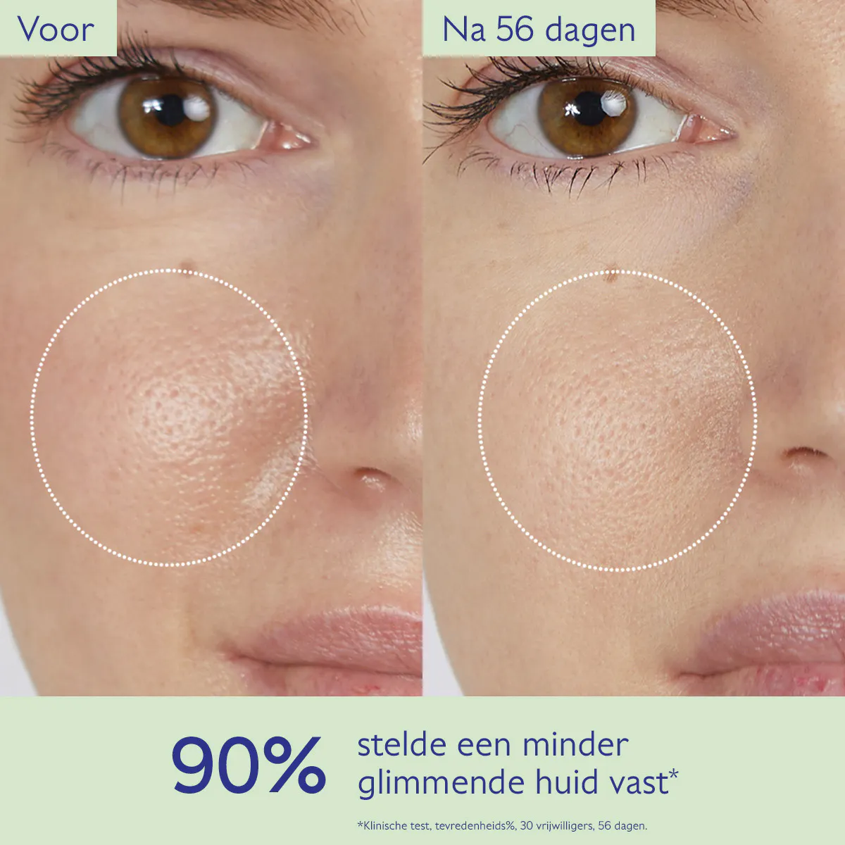 Zuiverende Lotion met Salicylzuur - 200mL