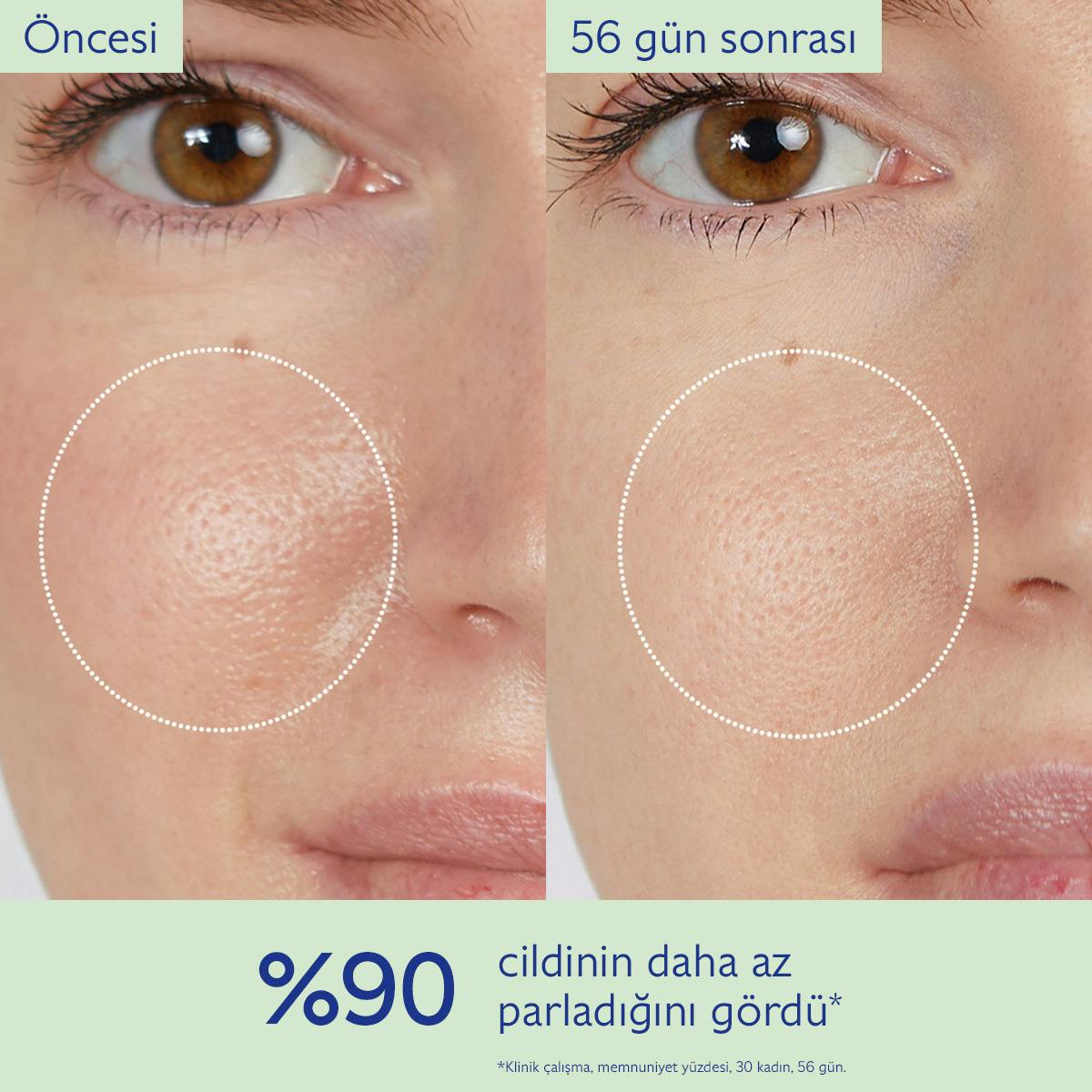 Akne Karşıtı Arındırıcı Tonik