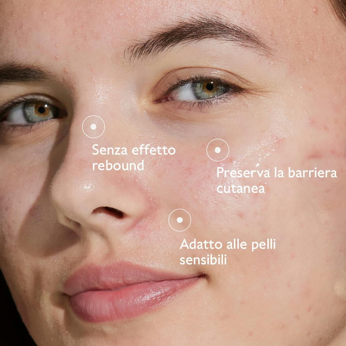 Siero all'Acido Salicilico Anti-imperfezioni