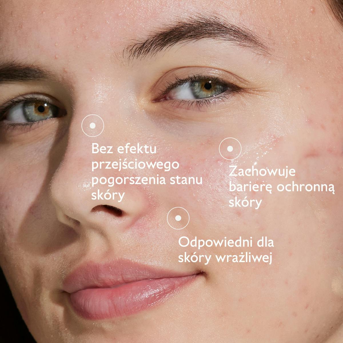 Serum z kwasem salicylowym na niedoskonałości