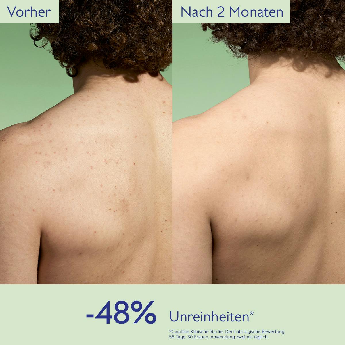 Klärender Toner mit Salicylsäure - 200mL