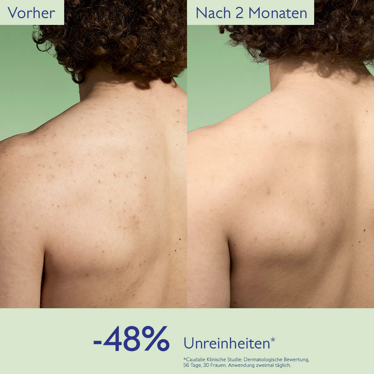 Klärender Toner mit Salicylsäure - 200mL