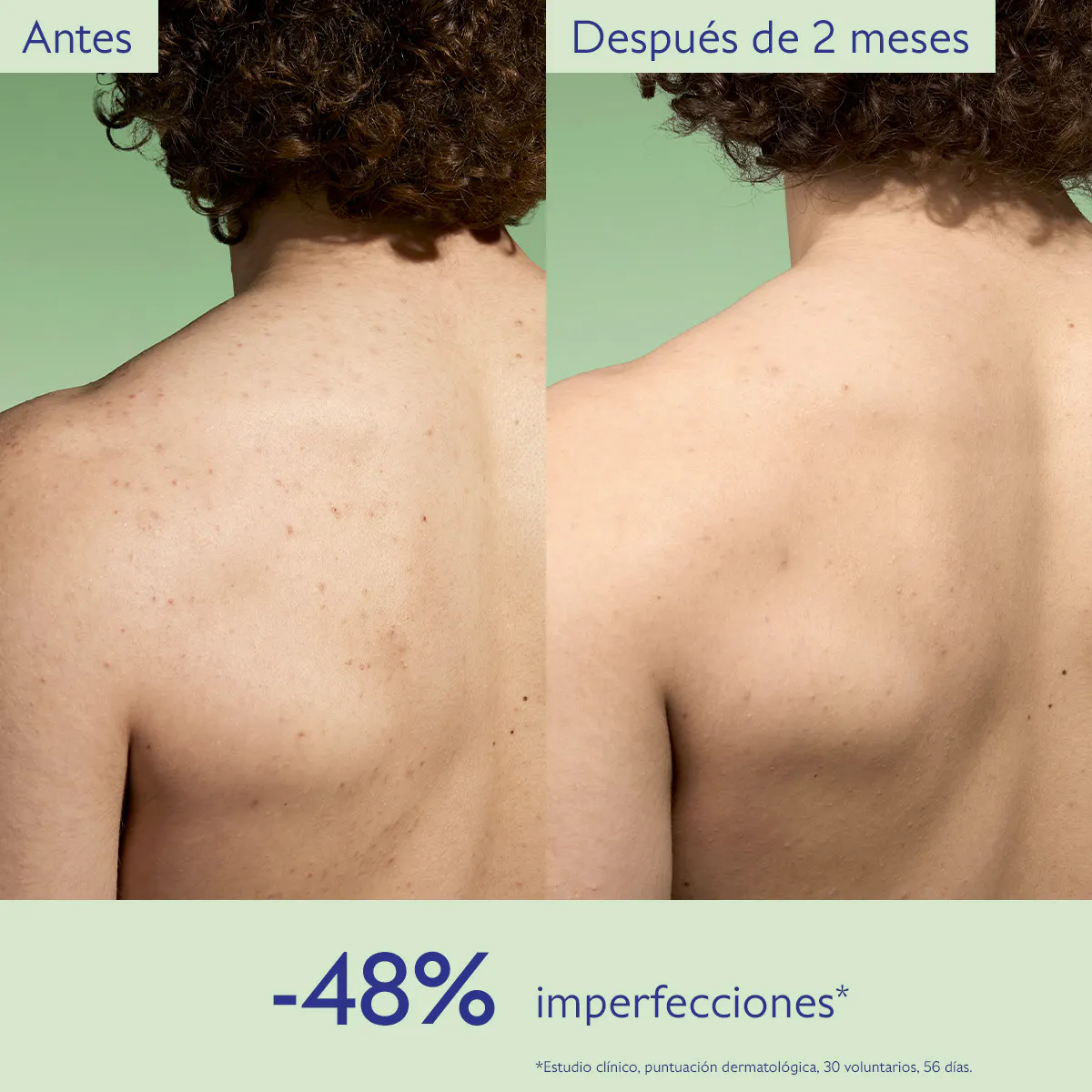 Tónico Purificante con Acido Salicílico - 200mL