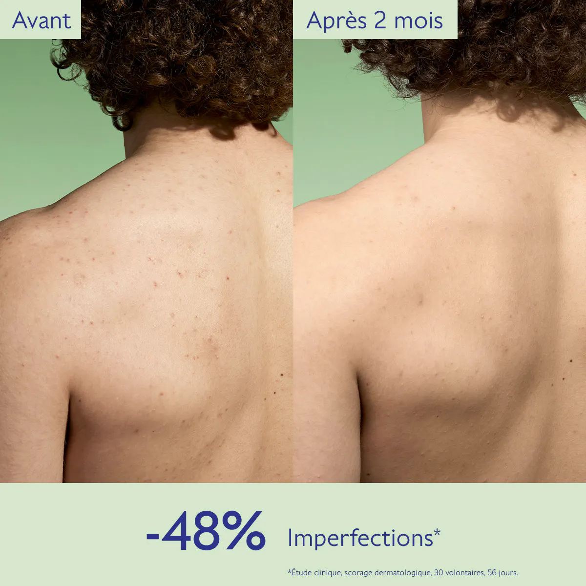 Lotion Purifiante à l'Acide Salicylique - 200mL