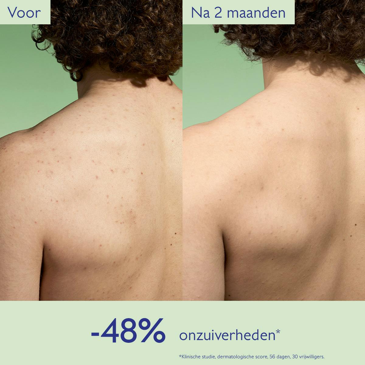 Zuiverende Lotion met Salicylzuur - 200mL
