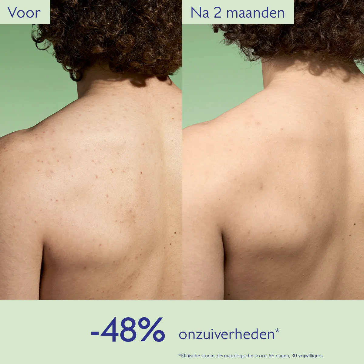 Zuiverende Lotion met Salicylzuur - 200mL