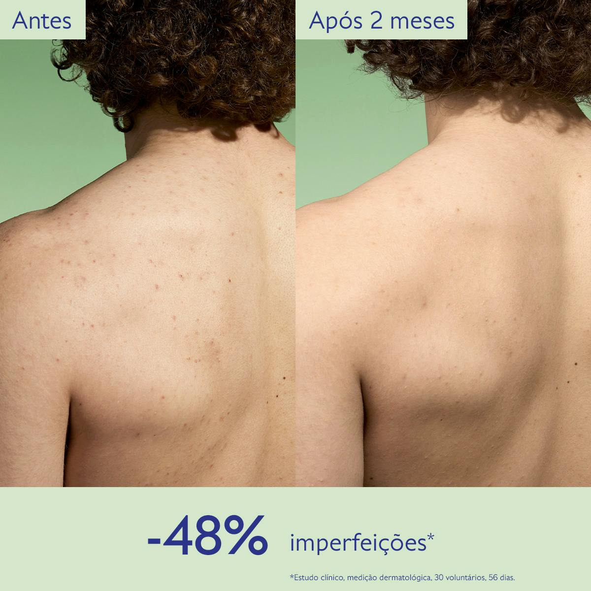 Loção Purificante com Acido Salicílico - 200mL