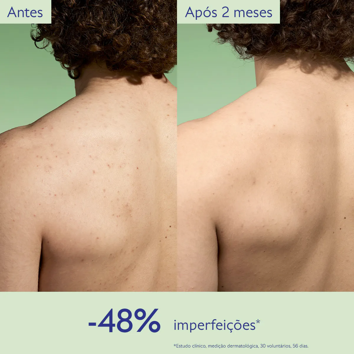 Loção Purificante com Acido Salicílico - 200mL