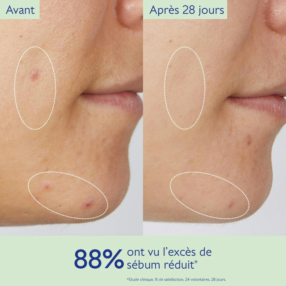 Gelée Nettoyante à l'Acide Salicylique Purifiante