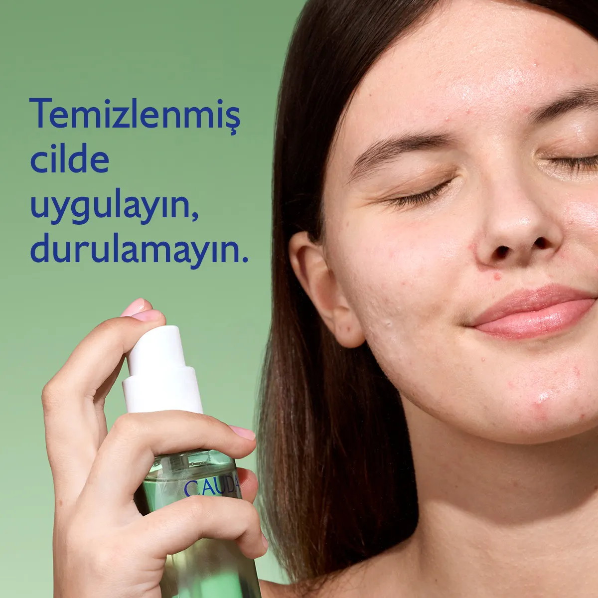 Akne Karşıtı Arındırıcı Tonik - 200ml