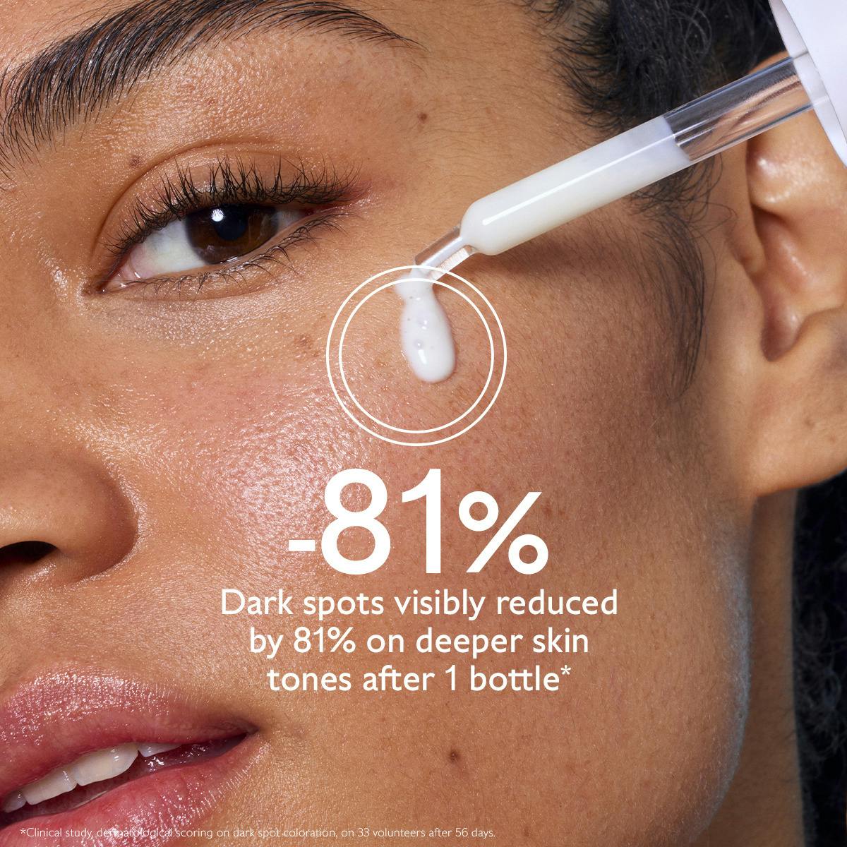 Dark Spot Brightening Serum Vitamin C Alternative