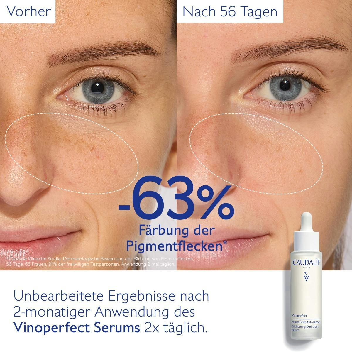 Serum für mehr Ausstrahlung und gegen Pigmentflecken mit Viniferine, Alternative zu Vitamin C