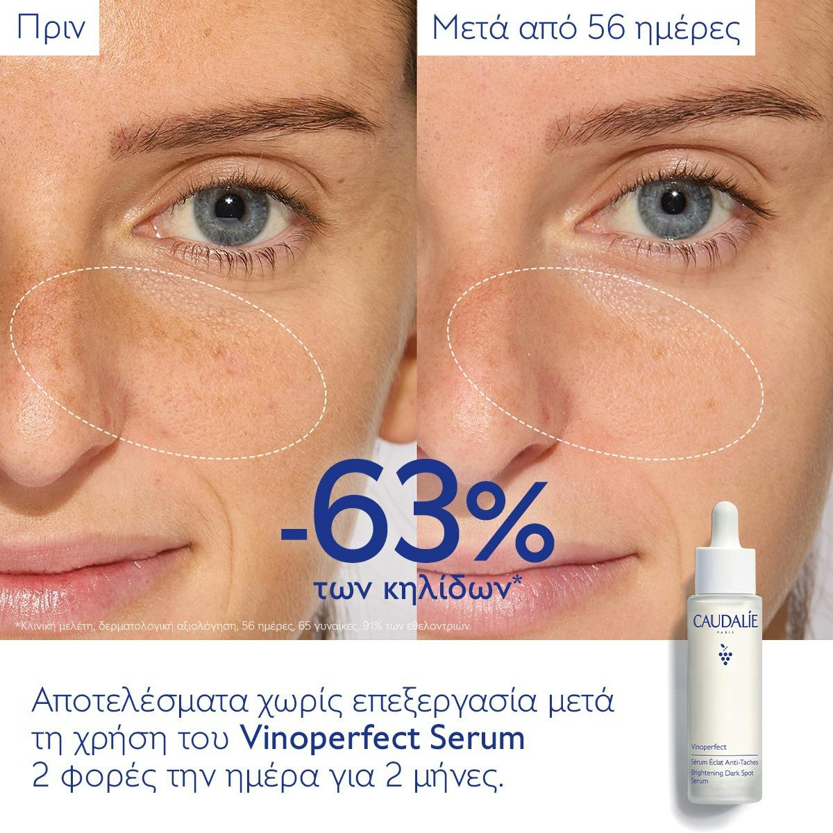 Brightening Dark Spot Serum Vitamin C Alternative