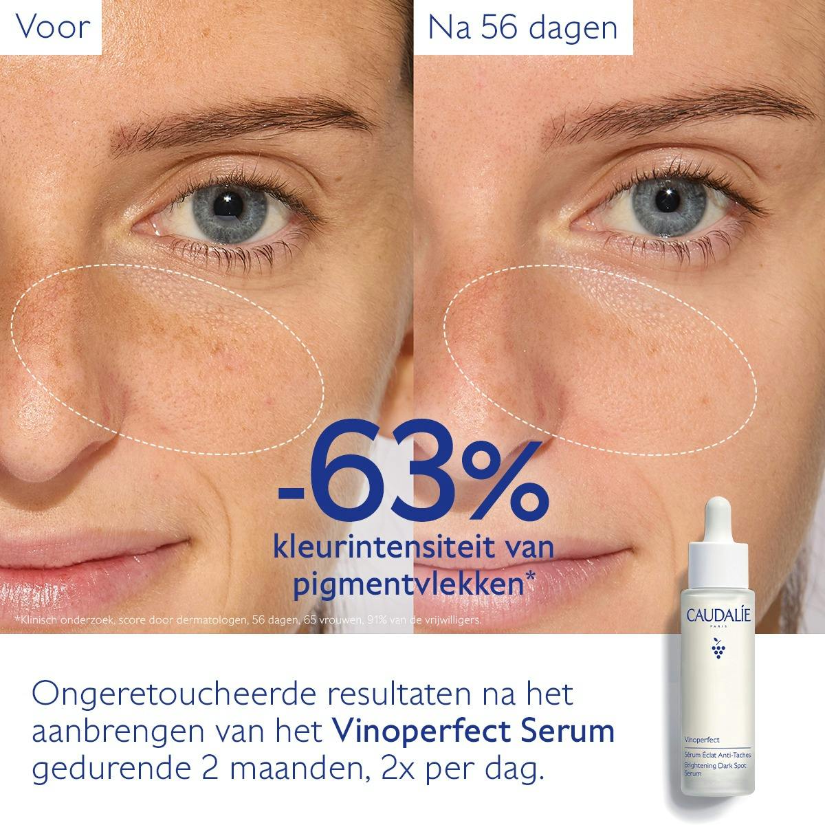 Serum Stralende Huid tegen Vlekken