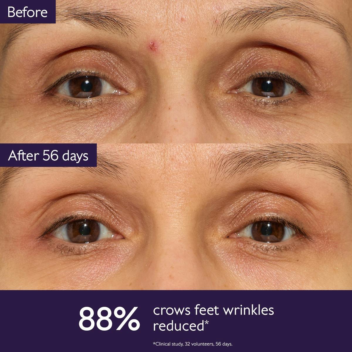 The Eye Cream with Longevity Patent + Natural Plumping Filler