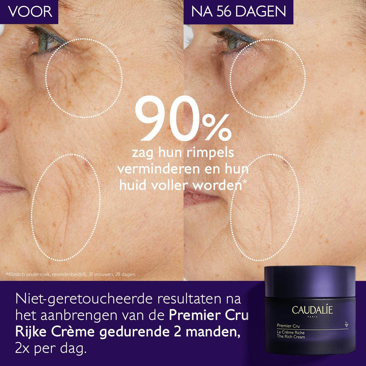 De globale anti-aging Rijke Crème