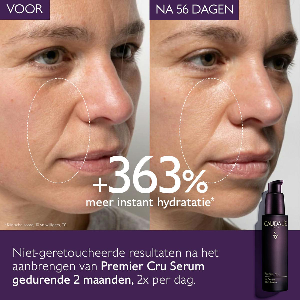 Het globale anti-aging Serum - Oude Collectie