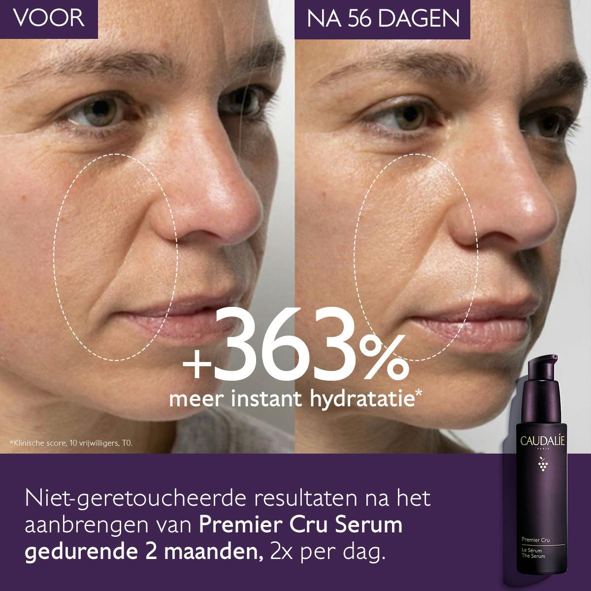 Het globale anti-aging Serum - Oude Collectie