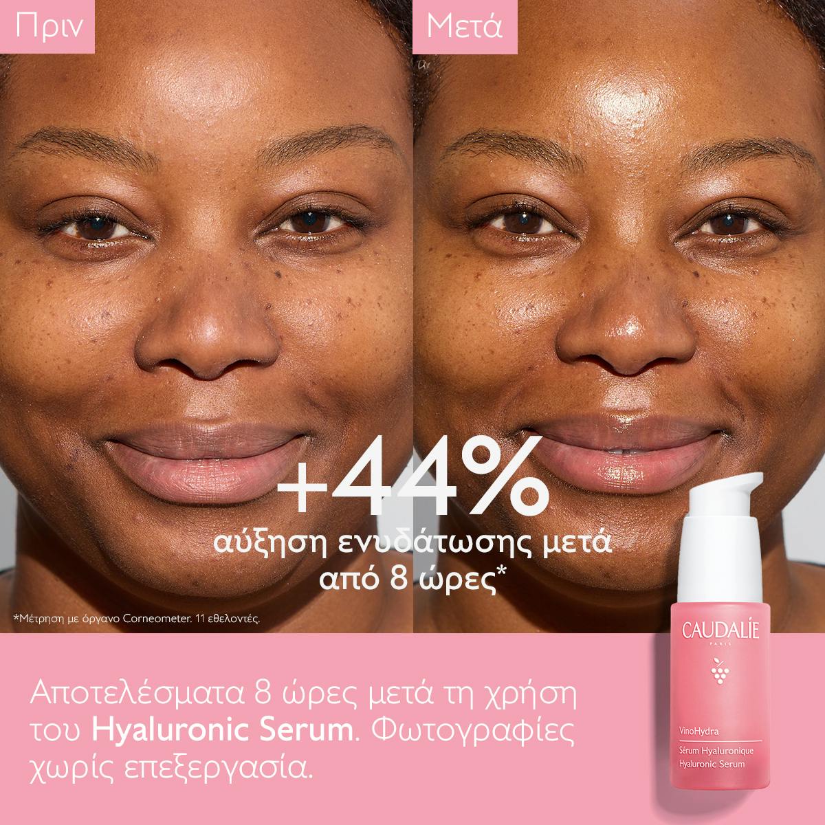 Hyaluronic Serum 