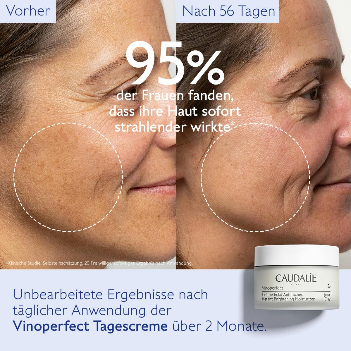 Anti-Pigmentflecken Creme - Ausstrahlung - Frühere Kollektion