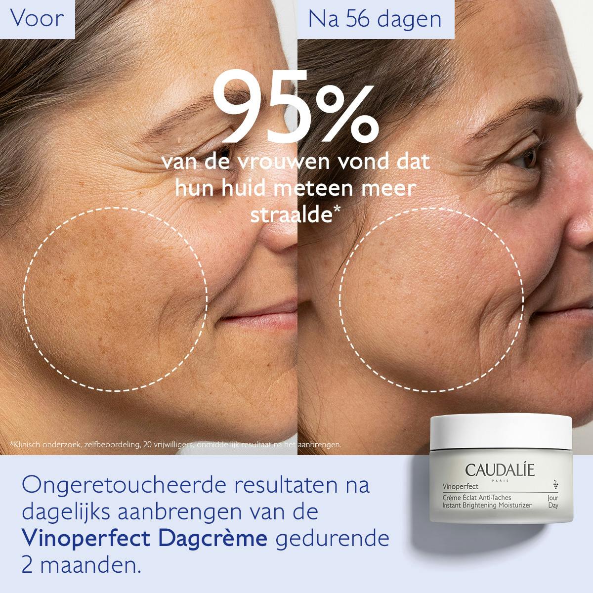 Dagcrème Stralende huid tegen vlekken