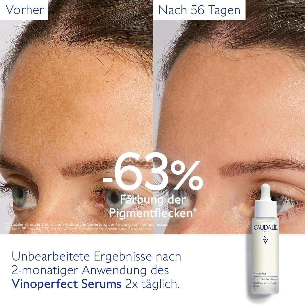 Serum für mehr Ausstrahlung und gegen Pigmentflecken mit Viniferine, Alternative zu Vitamin C
