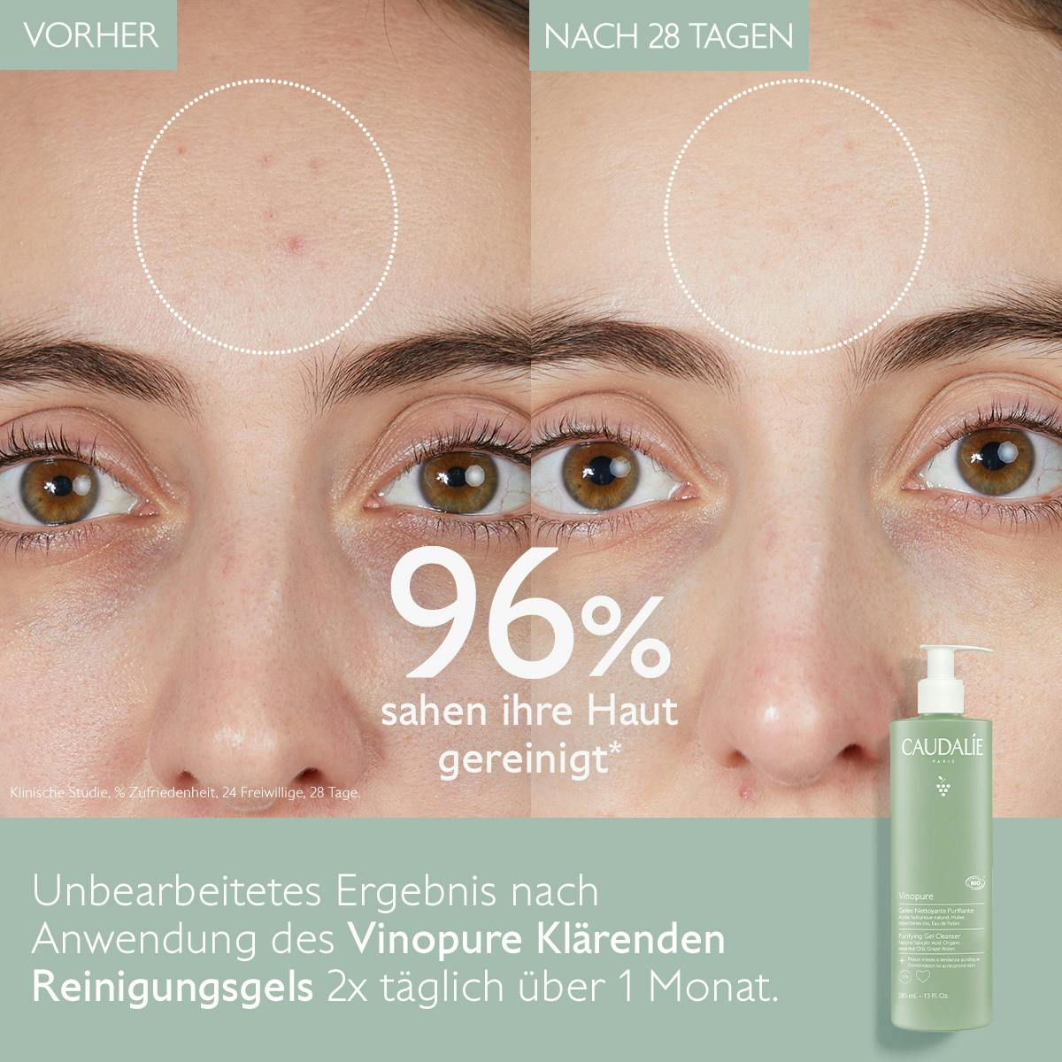 Klärendes Reinigungsgel mit Salicylsäure - 385mL