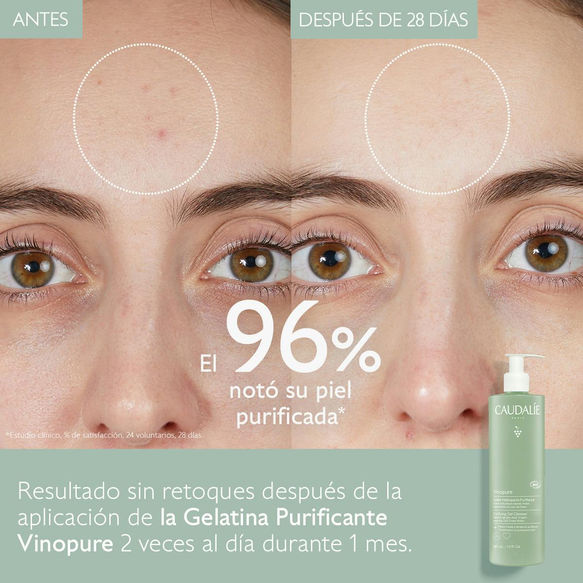 Gelatina Limpiadora Purificante con Ácido Salicílico - 385ml