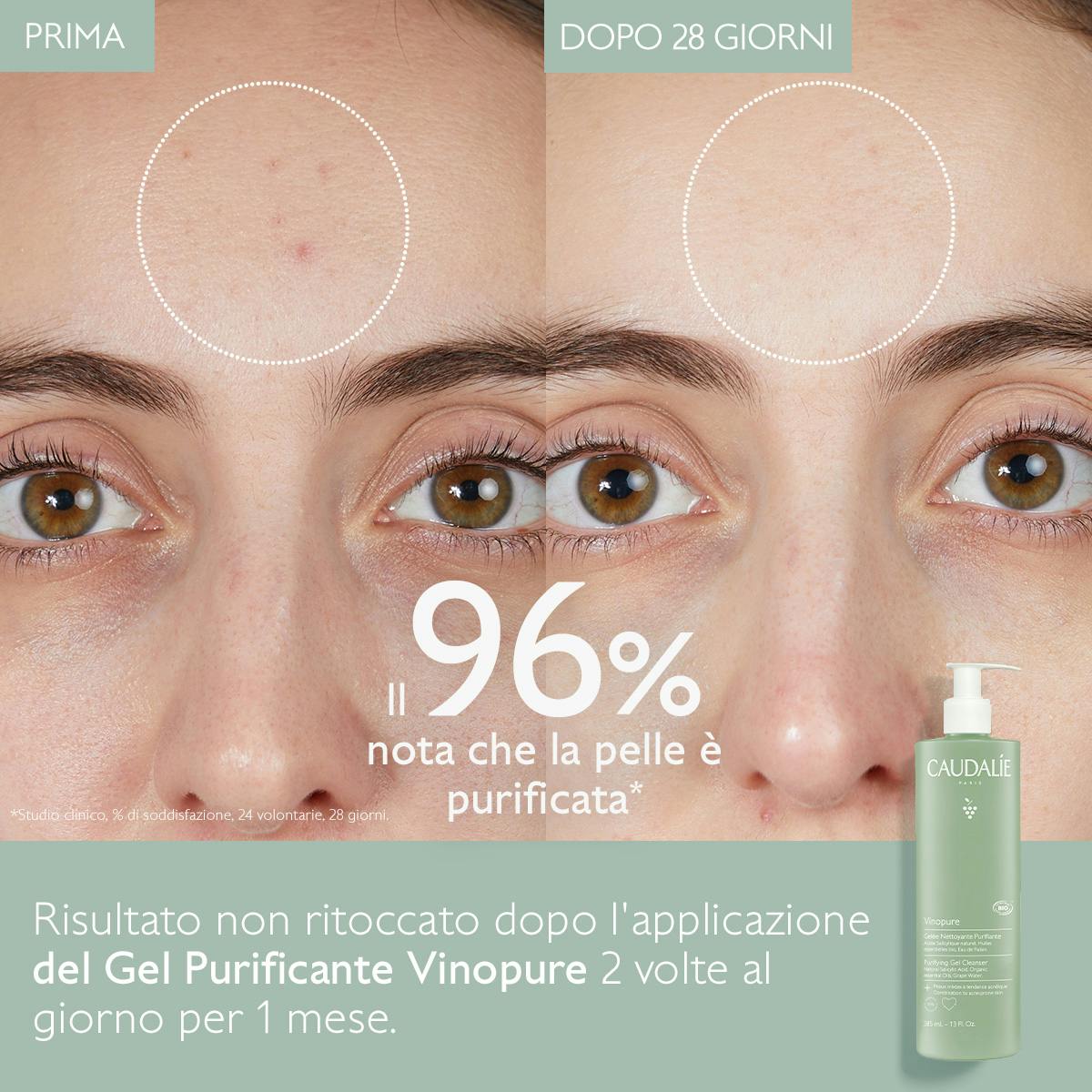 Gel Detergente Purificante con Acido Salicilico - 385ml