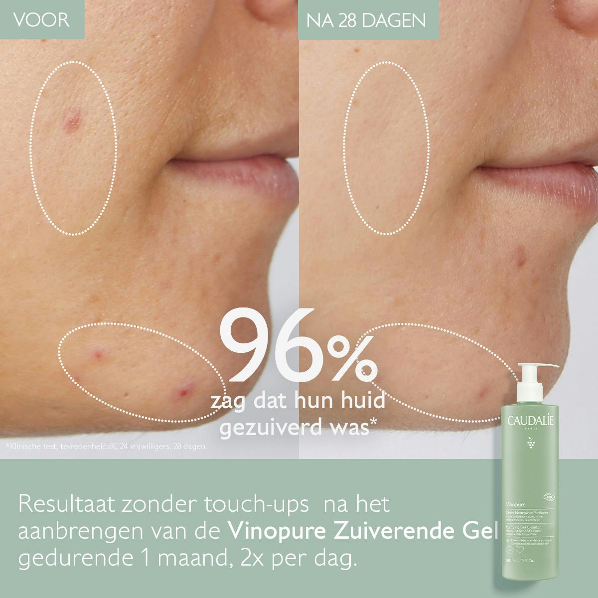 Zuiverende Reinigingsgel - 385mL