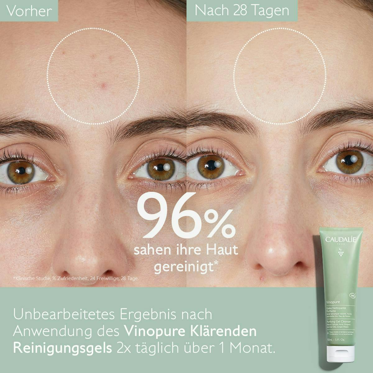 Duo Klärendes Reinigungsgel 150ml