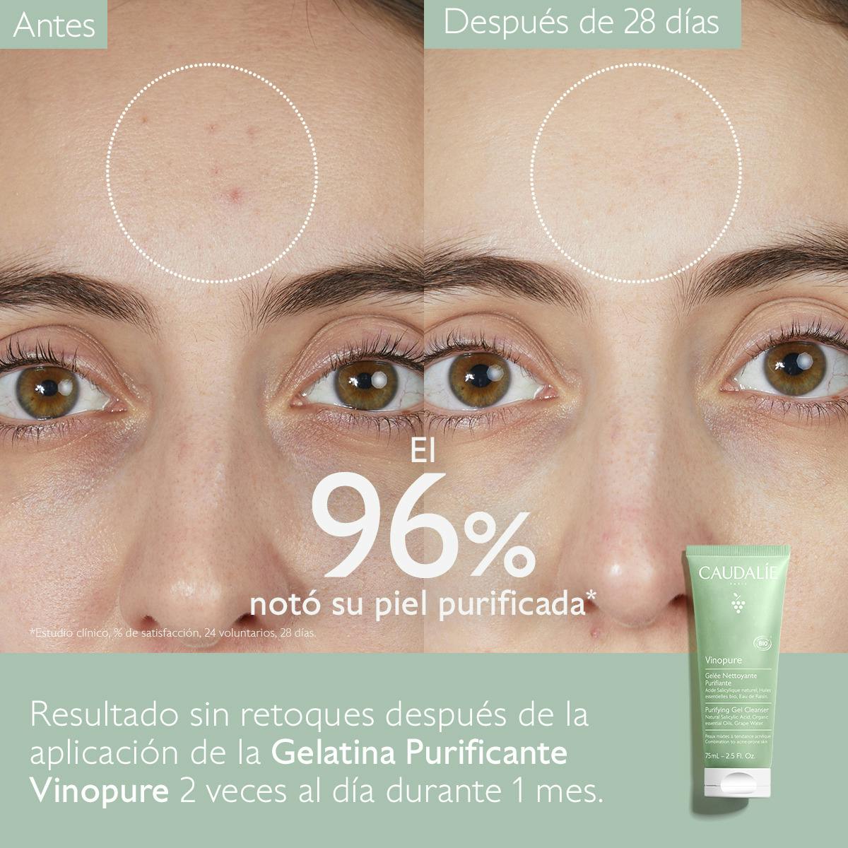 Gelatina Limpiadora Purificante con Ácido Salicílico - 75ml