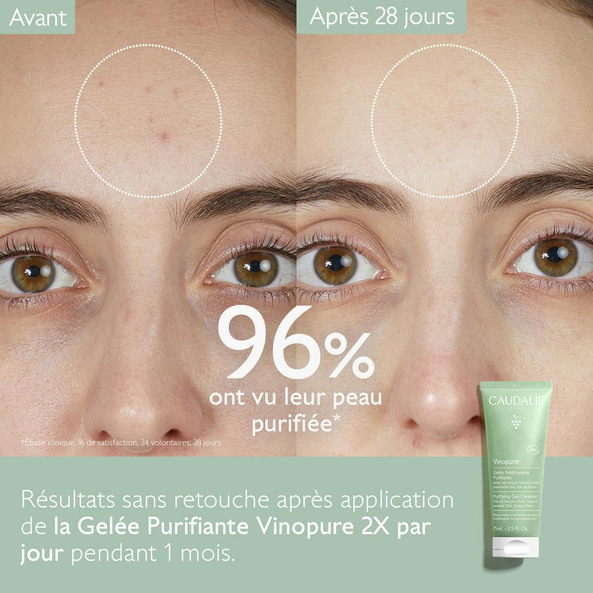 Gelée Nettoyante Purifiante à l'Acide Salicylique - 75mL