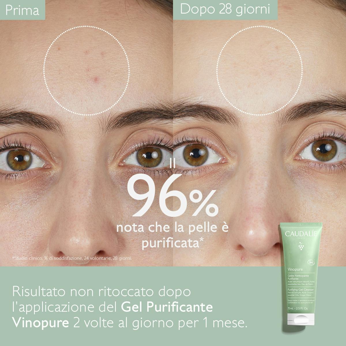 Gel Detergente Purificante con Acido Salicilico - 75ml