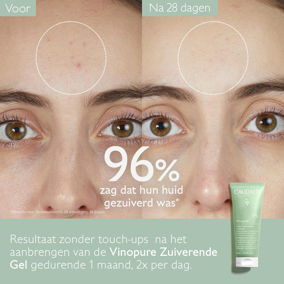 Zuiverende Reinigingsgel - 75mL