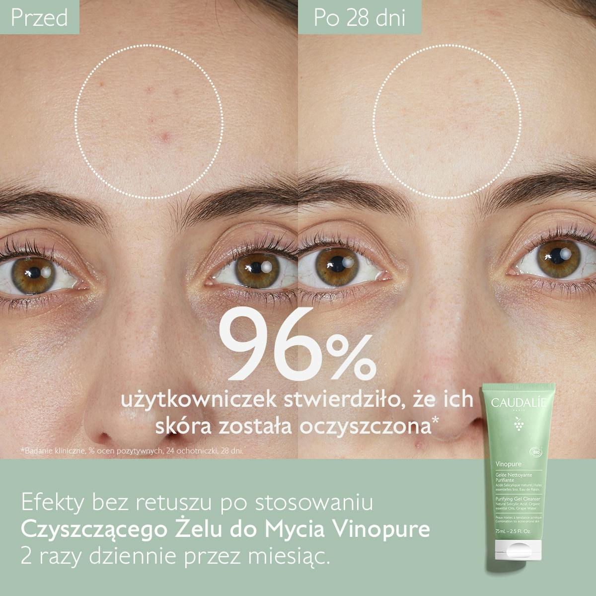 Oczyszczający żel myjący - 75mL